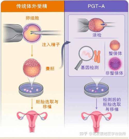 糖尿病人可做试管吗女性-糖尿病人能不能做试管婴儿