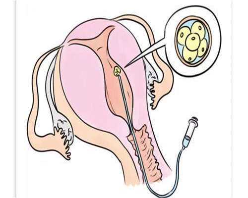 
              内蒙正规生殖中心冷冻卵子一年要多少钱？
            