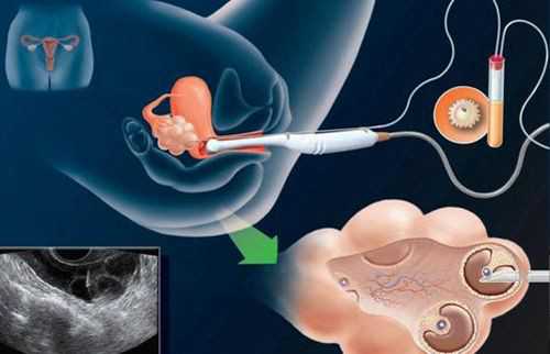 代怀包成功价格_包成功选性别,昆明试管怀孕多少钱