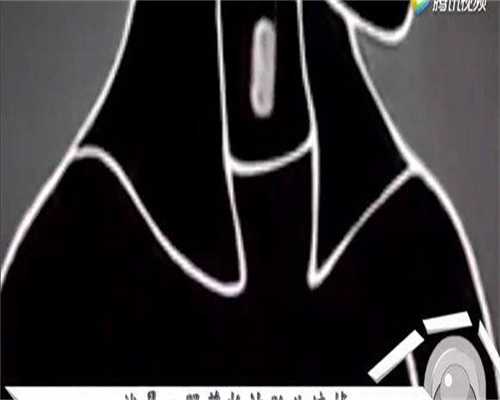 肇庆做三代试管成功率比较高的医院专家推荐