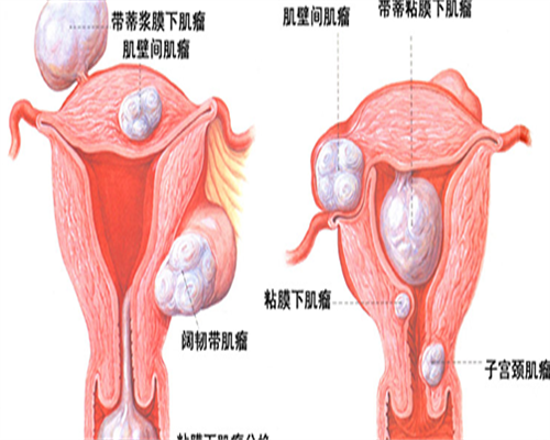 「为何做试管」为什么做试管要结扎输卵管