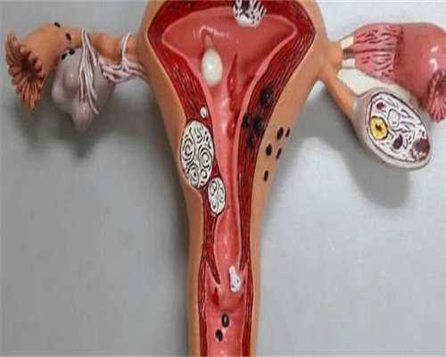 内蒙做试管婴儿去哪家医院成功率更高!去哪里好!