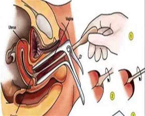 哈医大一院|内蒙正规生殖医院冷冻精子一年费用要多少!内蒙哪家医院能