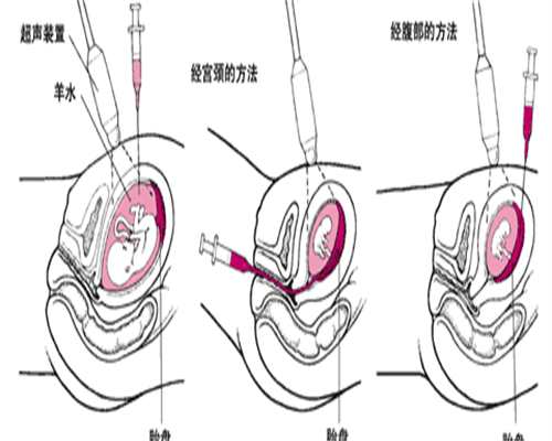 江苏省中医院做第二代正规代生孩子电话一次*我终于做妈妈啦